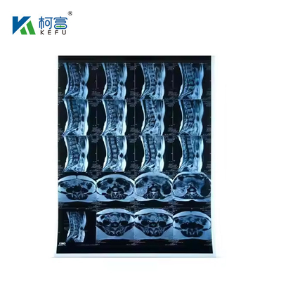 잉크젯 의료 엑스레이 블루 필름 210마이크론 CT DR 필름 A4 8x10 시트 또는 롤