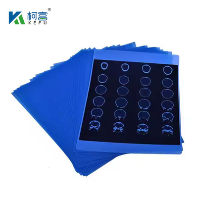 잉크젯 의료 엑스레이 블루 필름 210마이크론 CT DR 필름 A4 8x10 시트 또는 롤