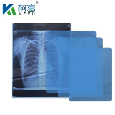 고화질 의료 영상 CT DR 잉크젯 의료 엑스레이 애완 동물 필름 175mic 215mic 투명 블루 프린팅 필름