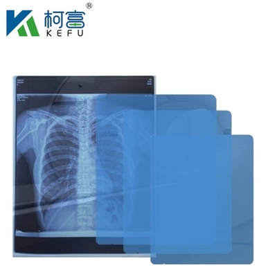 의료용 엑스레이/CT/DR 건조 스캔 필름 엑스레이 레이저 이미지 프린터 및 열 이미지 프린터 장비