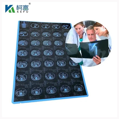 스크래치 저항 및 내구성있는 의료 레이저 필름 6x8in 0.10mm 바쁜 의료 환경에서 장기 사용을 보장합니다