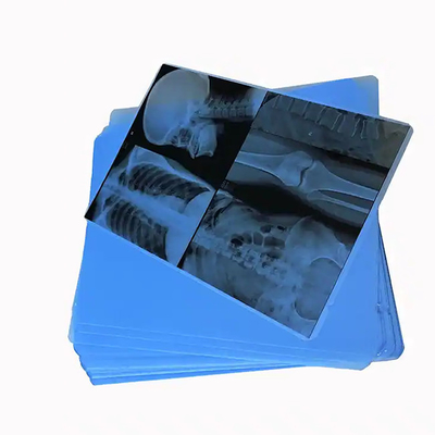 125 미크론 반투명 백색 레이저 의료용 X-Ray PET 플라스틱 필름을 발견하십시오.
