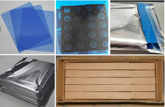 블루 잉크젯 엑스레이 필름 의료 건조 필름 A4 A3 시트