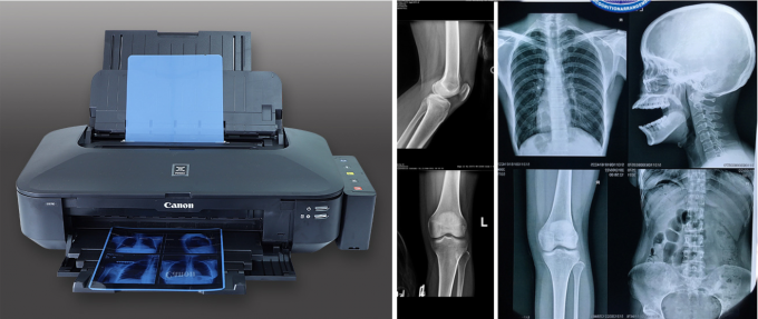 잉크젯 프린터와 명확하고 정확한 영상 촬영을 위한 블루 의료 엑스레이 필름 5